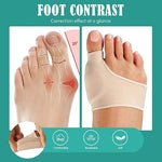 Corrector Juanetes