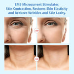 Masajeador facial Ledterapia